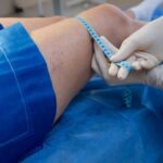 Understanding Butt Fillers and Non-Surgical Glute Enhancement Options