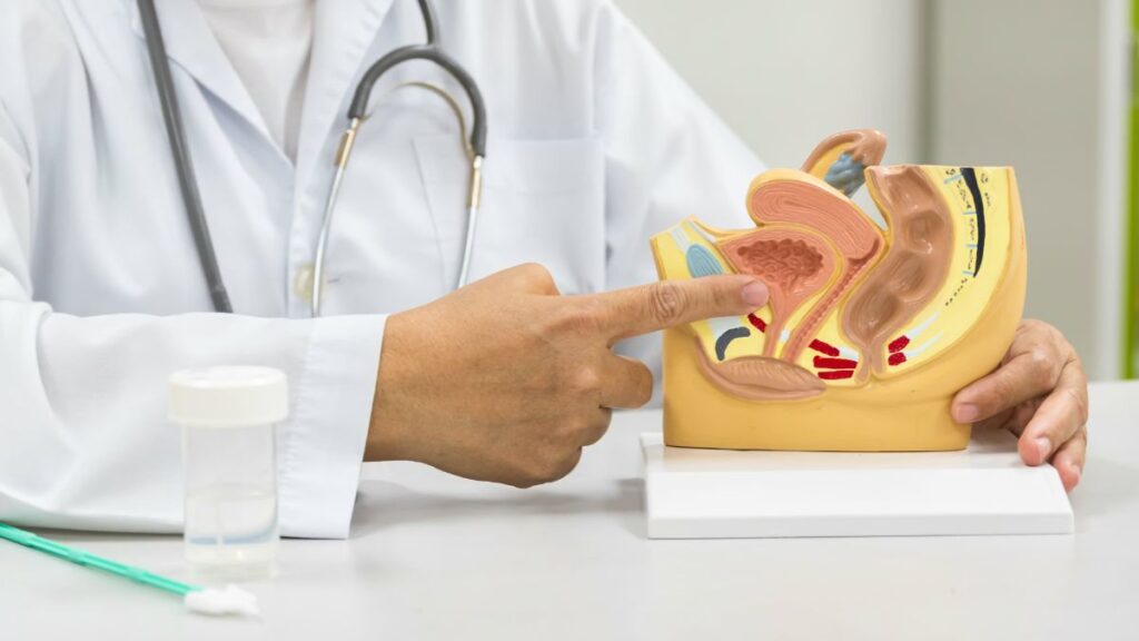 gynecube